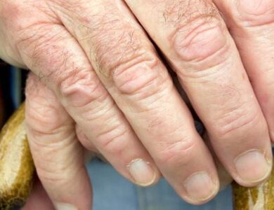 idade minima aposentadoria