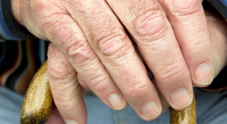 idade minima aposentadoria